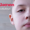 ภาวะหนังตาตก