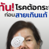 รู้ทัน โรคต้อกระจก