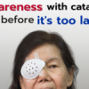 Awareness with cataract