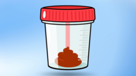 Did you know? What diseases can bloody stool indicate?