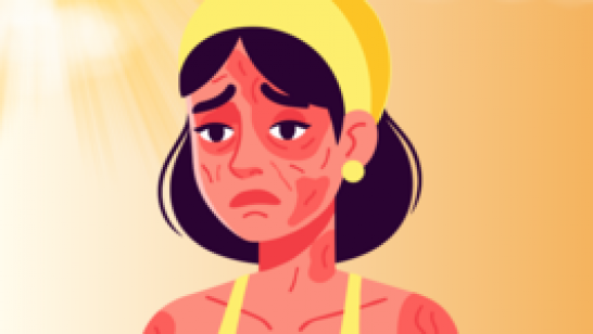 รู้หรือไม่? แดดหน้าหนาวอันตรายมากกว่าถึง 2 เท่า