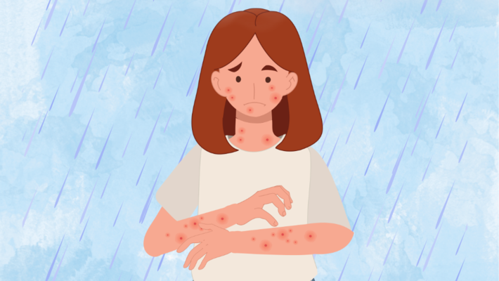 6 Skin diseases to Watch Out for During the Rainy Season
