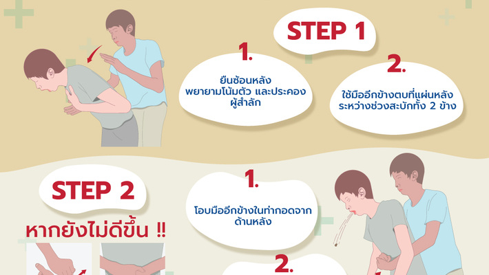 เมื่อ ‘คนสำลักอาหาร’ ต้องช่วยเหลืออย่างไร ?