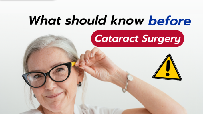 What should know before Cataract Surgery