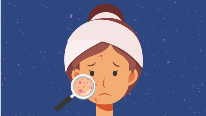 What kind of skin? Warning signs of 