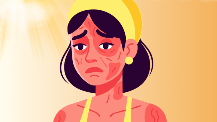 รู้หรือไม่? แดดหน้าหนาวอันตรายมากกว่าถึง 2 เท่า