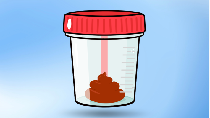 Did you know? What diseases can bloody stool indicate?