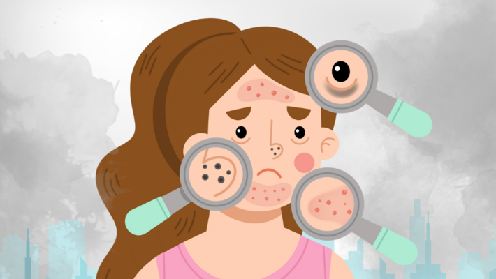 Did you know PM2.5 dust is a villain that destroys facial skin