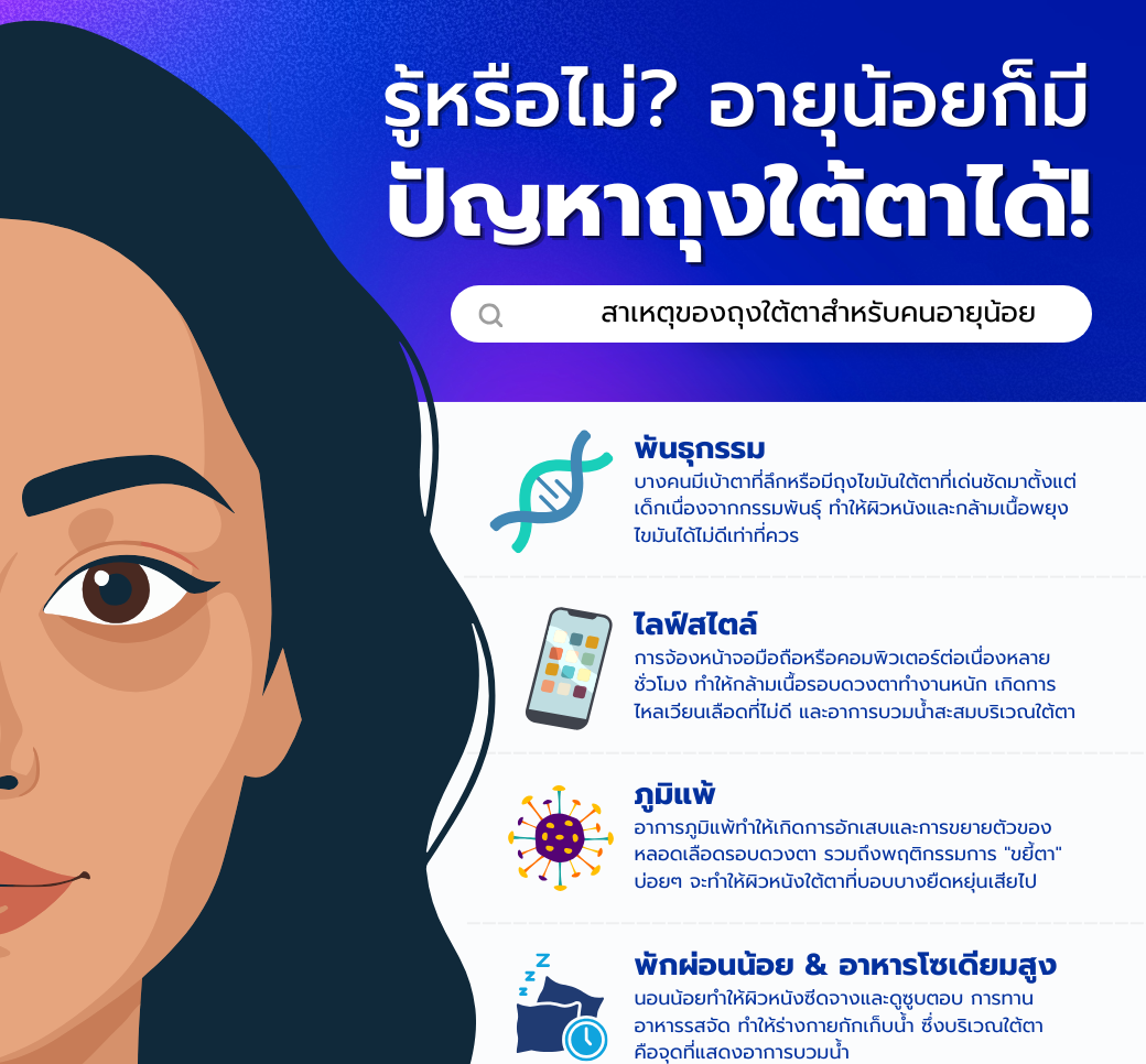 รู้หรือไม่อายุน้อยก็มีปัญหาถุงใต้ตาได้.png