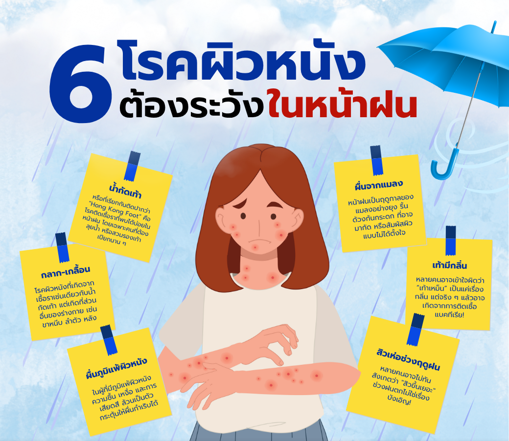 6โรคผิวหนังที่ต้องระวังในฤดูฝน.png