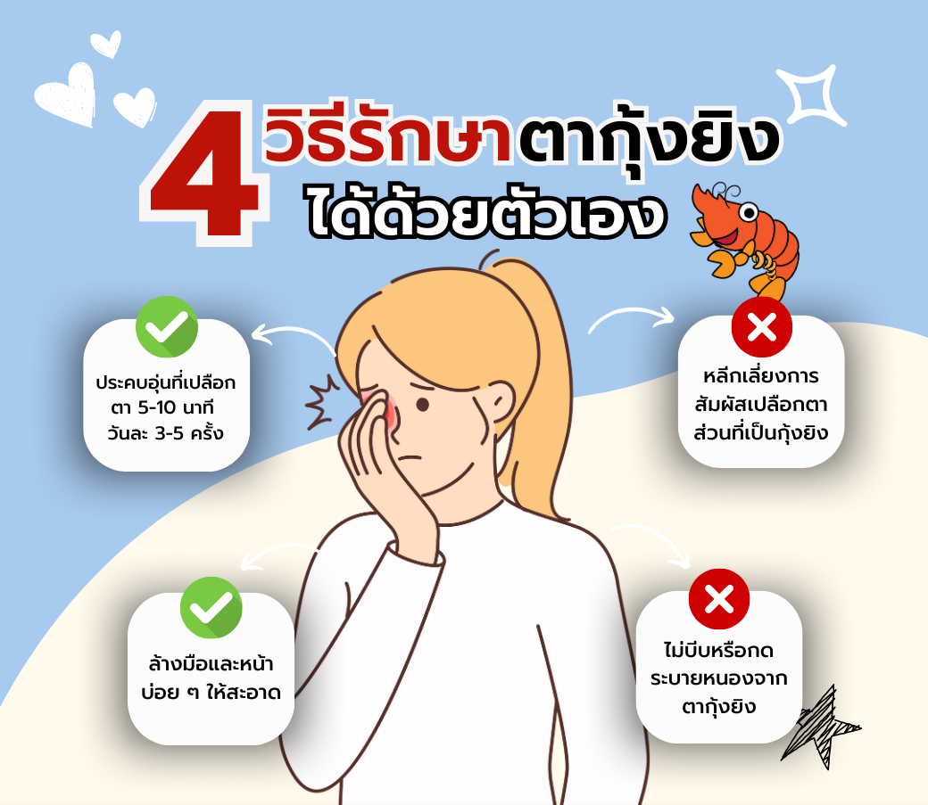 วิธีรักษาตากุ้งยิงได้ด้วยตัวเอง.png