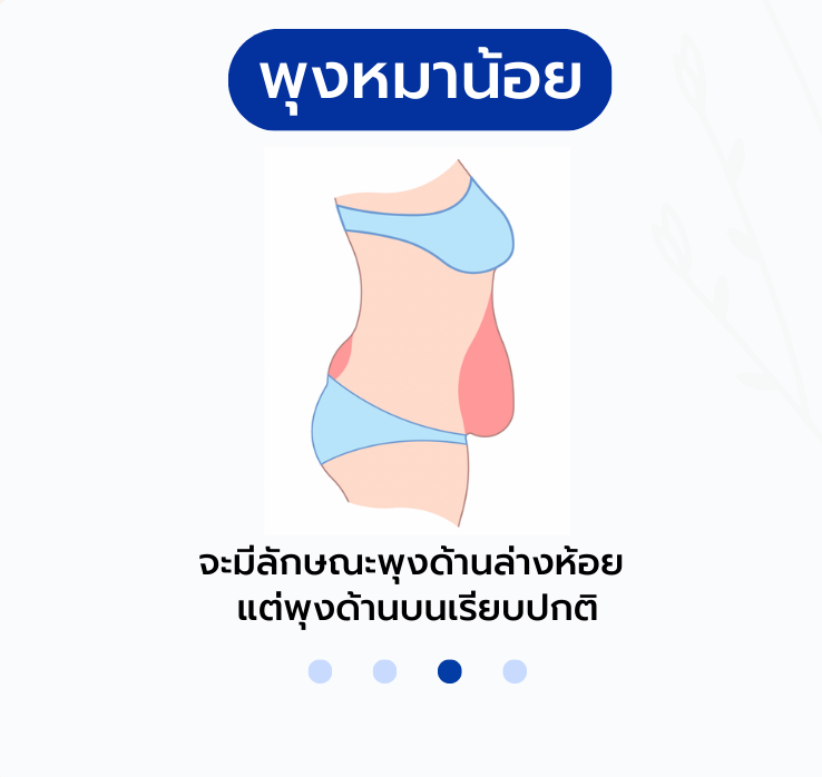 4.png