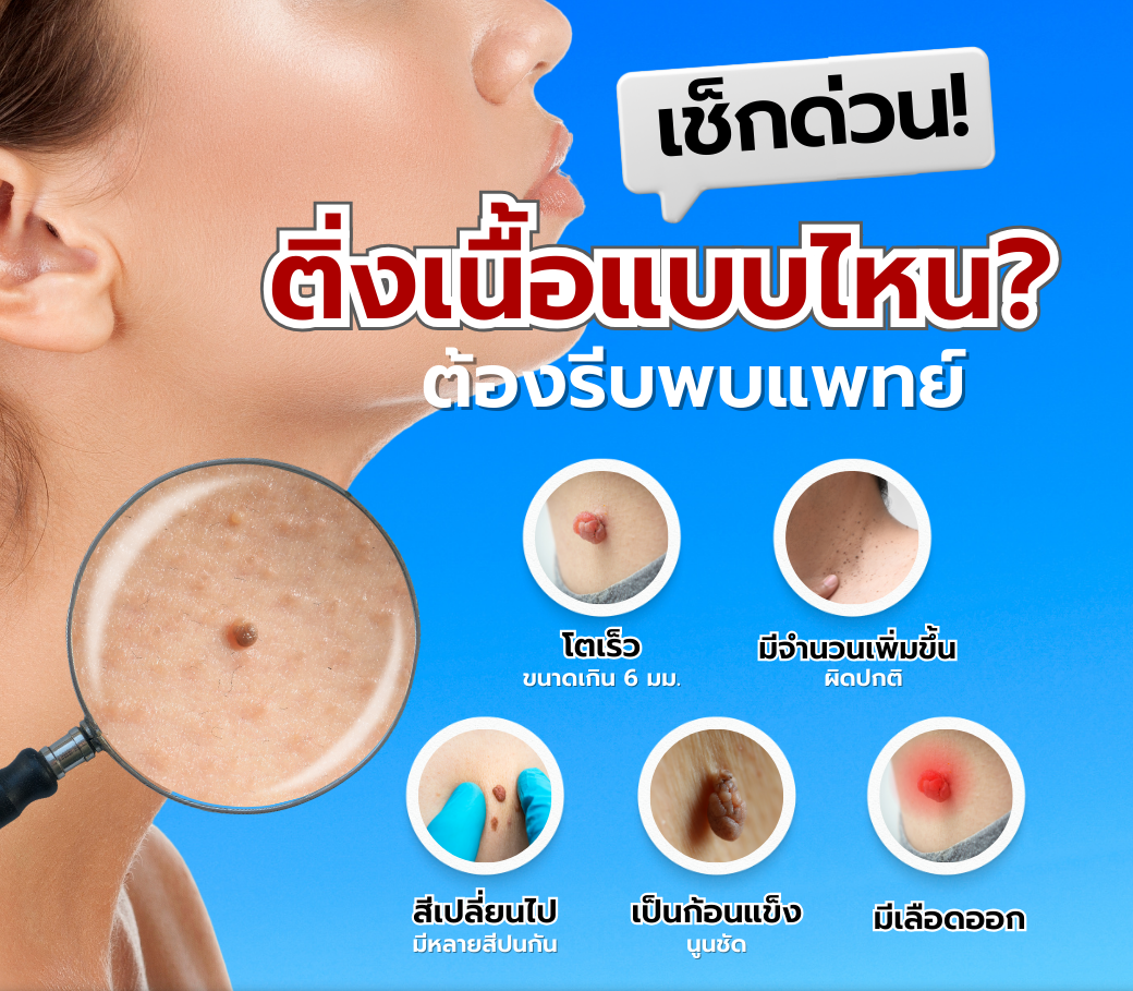 เช็กติ่งเนื้อที่คอแบบไหนผิดปกติเสี่ยงมะเร็ง.png