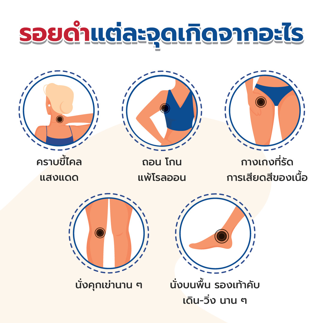 ไม่อยากเสียความมั่นใจเพราะ-‘รอยดำตามร่างกาย’-ดูแลอย่างไรให้รอยจางลง1080-1080ชุด1.jpg