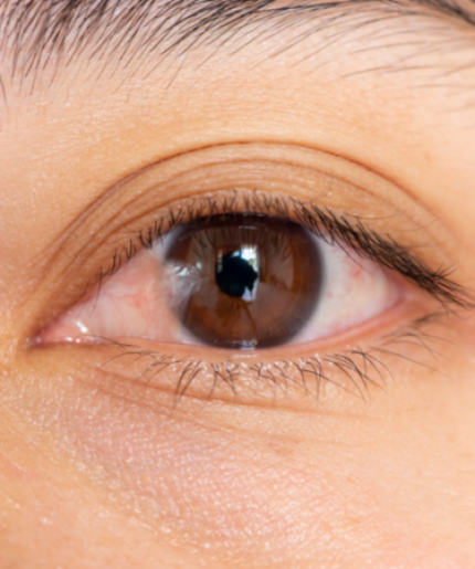 แพ็กเกจผ่าตัดต้อเนื้อ