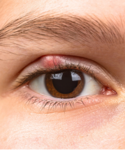 แพ็กเกจเจาะตากุ้งยิง