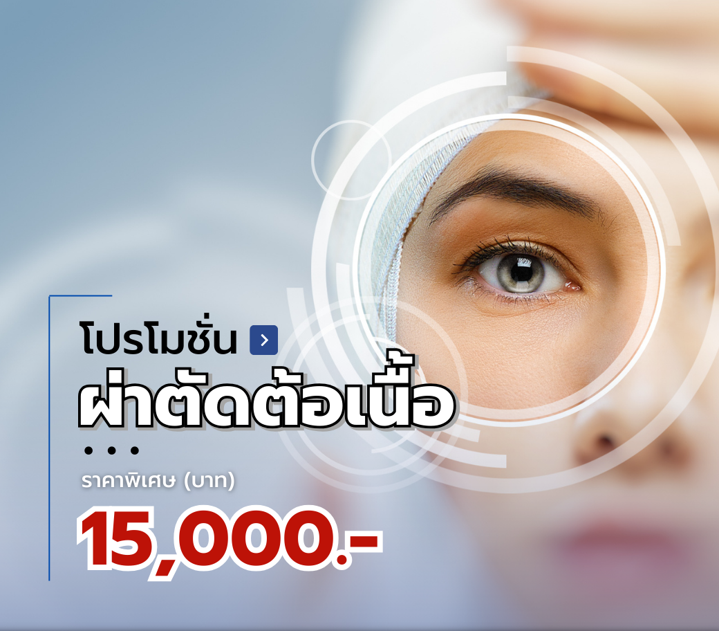 แพ็กเกจผ่าตัดตาต้อเนื้อ.png