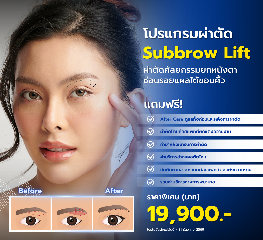 โปรแกรมSubbrowLift.png