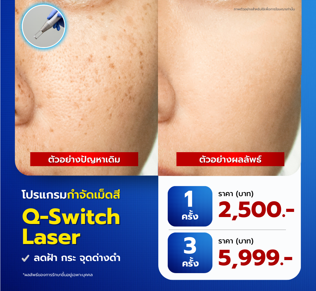 โปรแกรมqswitchLaser.png