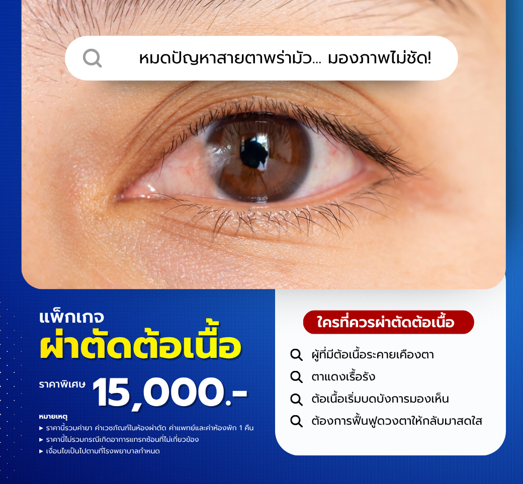 แพ็กเกจผ่าตัดต้อเนื้อ.png