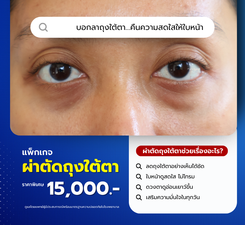 แพ็กเกจผ่าตัดถุงใต้ตา.png