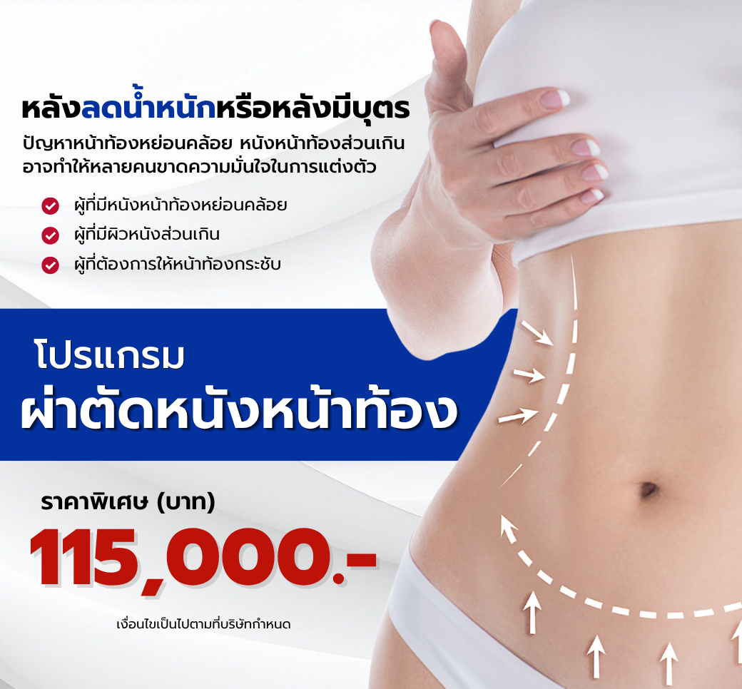 โปรแกรมผ่าตัดไขมันหน้าท้อง.png
